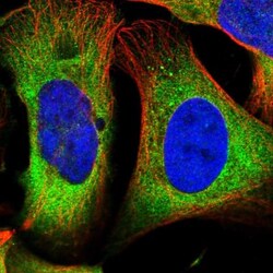 DARS Antibody, Novus Biologicals 0.1mL; Unlabeled:Antibodies, Polyclonal